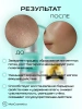 Сыворотка с ПДРН для сияния кожи Anua PDRN Hyaluronic Acid Capsule 100 Serum 30 мл | Москосметикс