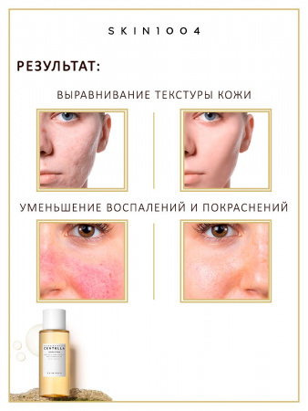 Мягкий отшелушивающий тонер для лица, увлажняющий тоник с центеллой азиатской корейская косметика бренда SKIN1004 Madagascar Centella Toning Toner 210 мл | Москосметикс