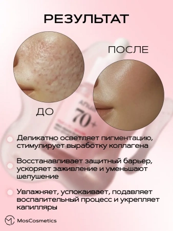 Сыворотка с персиком для гладкой и сияющей кожи Anua Peach 70% Niacin Serum 30 мл | Москосметикс
