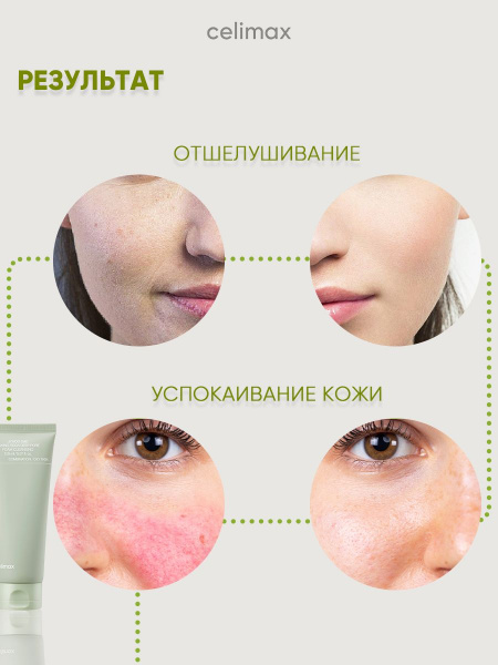 Пенка для умывания лица и снятия макияжа с содой глубокого очищения 150 мл, корейская косметика бренда CELIMAX Jiwoogae baking soda deep pore | Москосметикс